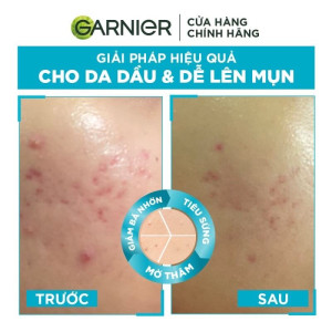 Serum Garnier Bright Complete Anti-Acnes Booster 4%