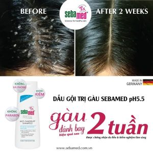 Dầu Gội Sebamed Hair Care Anti-Dandruff Shampoo pH5.5